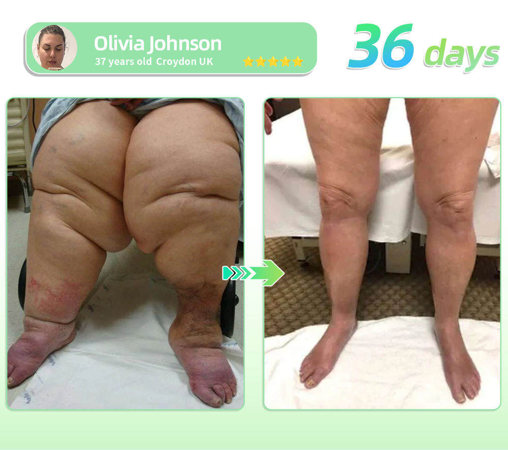 𝑶𝒇𝒇𝒊𝒄𝒊𝒂𝒍 𝑺𝒕𝒐𝒓𝒆🏅𝑯𝑯𝑽𝑩® ☘️𝐆𝐋𝐏-𝟏 𝐒𝐥𝐢𝐦𝐦𝐢𝐧𝐠 & 𝐇𝐞𝐚𝐥𝐭𝐡 𝐔𝐥𝐭𝐫𝐚 𝐂𝐨𝐧𝐜𝐞𝐧𝐭𝐫𝐚𝐭𝐞𝐝 𝐄𝐬𝐬𝐞𝐧𝐜𝐞 𝐋𝐢𝐪𝐮𝐢𝐝 𝐁𝐞𝐚𝐝𝐬 ✅ 𝐬𝐩𝐞𝐞𝐝𝐲, 𝐥𝐨𝐧𝐠-𝐥𝐚𝐬𝐭𝐢𝐧𝐠, 𝐚𝐝𝐝𝐫𝐞𝐬𝐬𝐢𝐧𝐠 𝐝𝐢𝐚𝐛𝐞𝐭𝐞𝐬, 𝐨𝐛𝐞𝐬𝐢𝐭𝐲, 𝐚𝐧𝐝 𝐜𝐚𝐫𝐝𝐢𝐨𝐯𝐚𝐬𝐜𝐮𝐥𝐚𝐫 𝐝𝐢𝐬𝐞𝐚𝐬𝐞𝐬 ✅𝒗𝒊𝒔𝒊𝒃𝒍𝒆 𝒄𝒉𝒂𝒏𝒈𝒆𝒔 𝒊𝒏 7𝒅𝒂𝒚𝒔